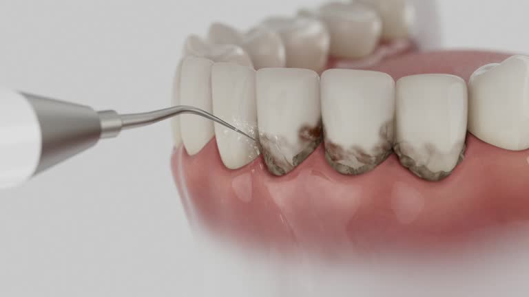 Reliable Dental Implants contractor in Merlin, OR by Smile Center Dentistry
